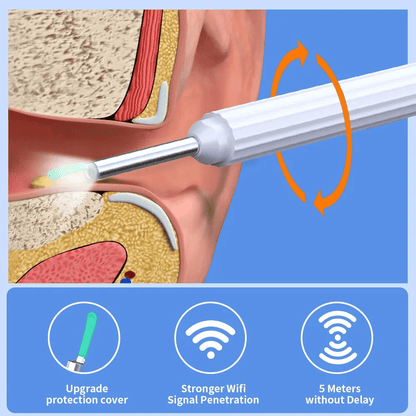 FLASH SALE UP TO 49% OFF - All-in-One Earwax Removal Tool